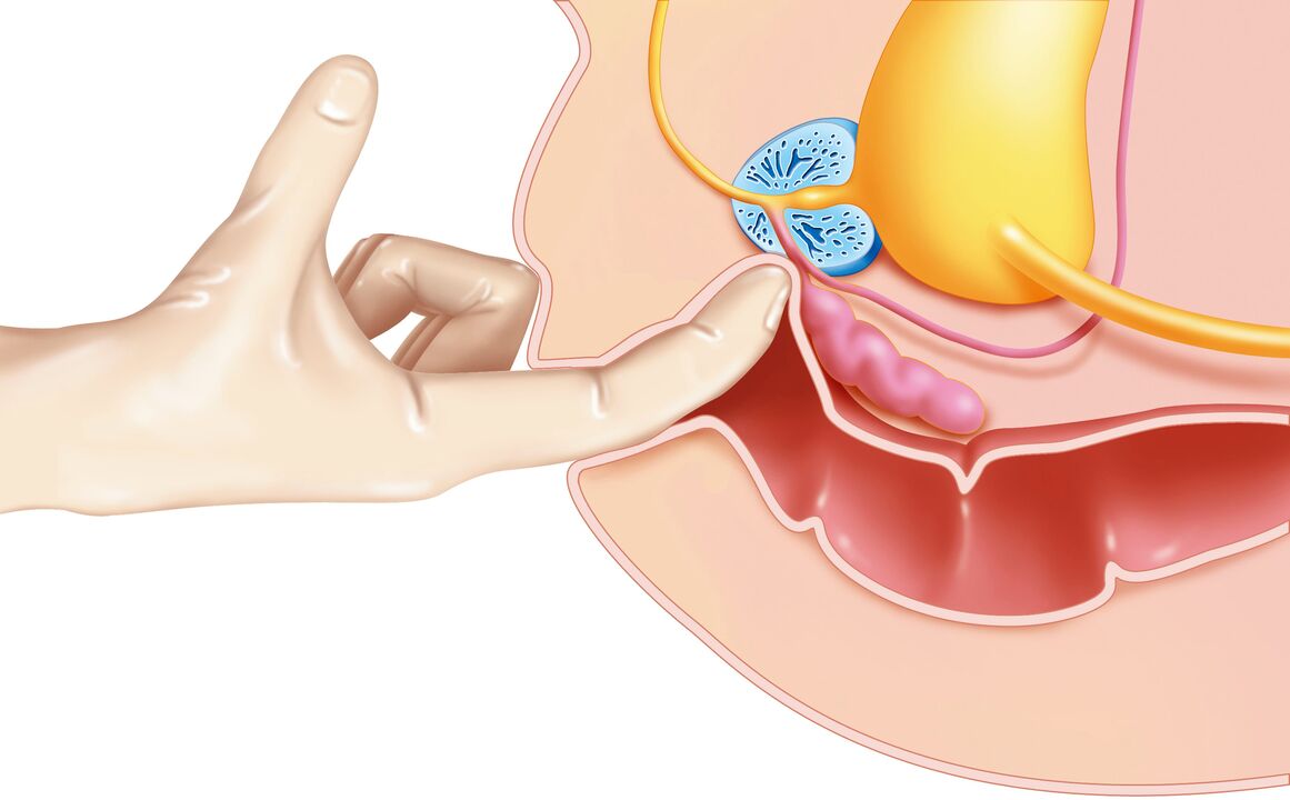 Stimulation of the G-spot in men